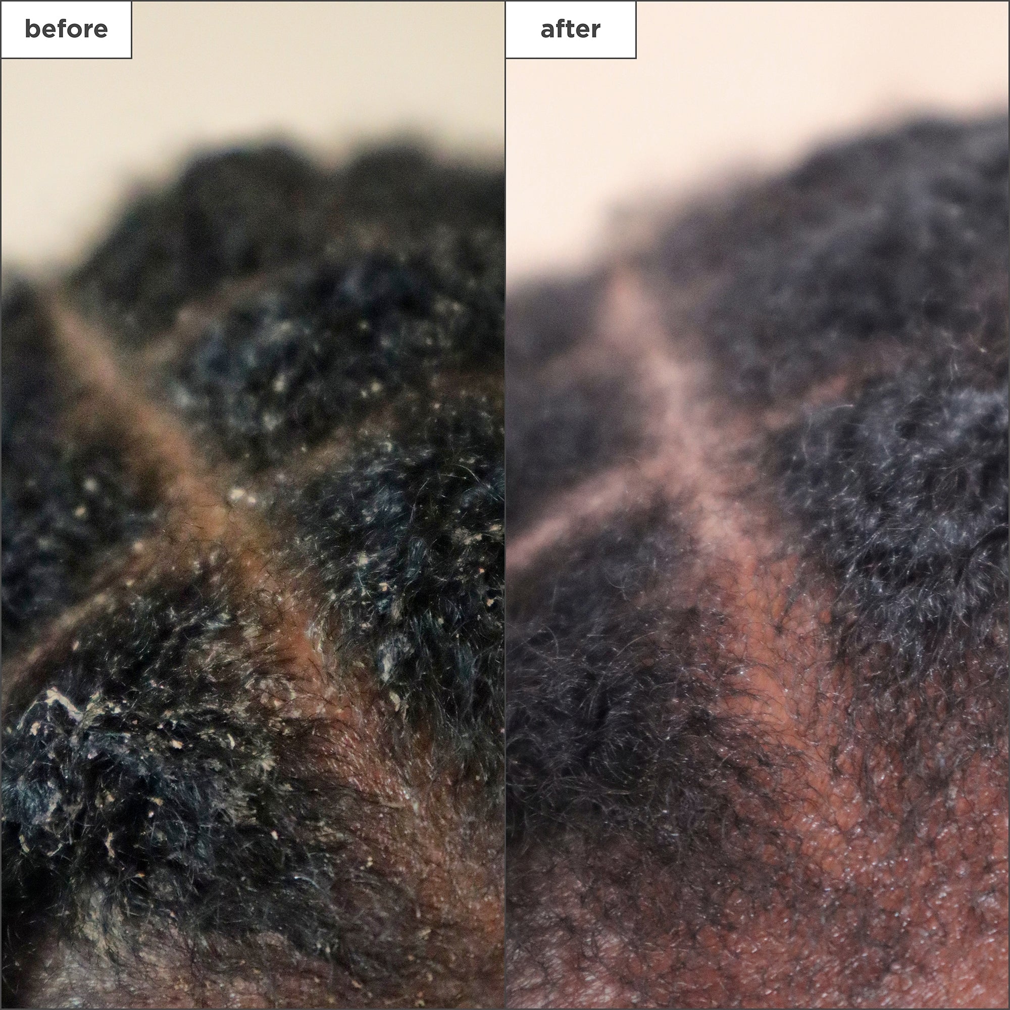 Scalp Revival Charcoal + Tea Tree Scalp Treatment - Briogeo